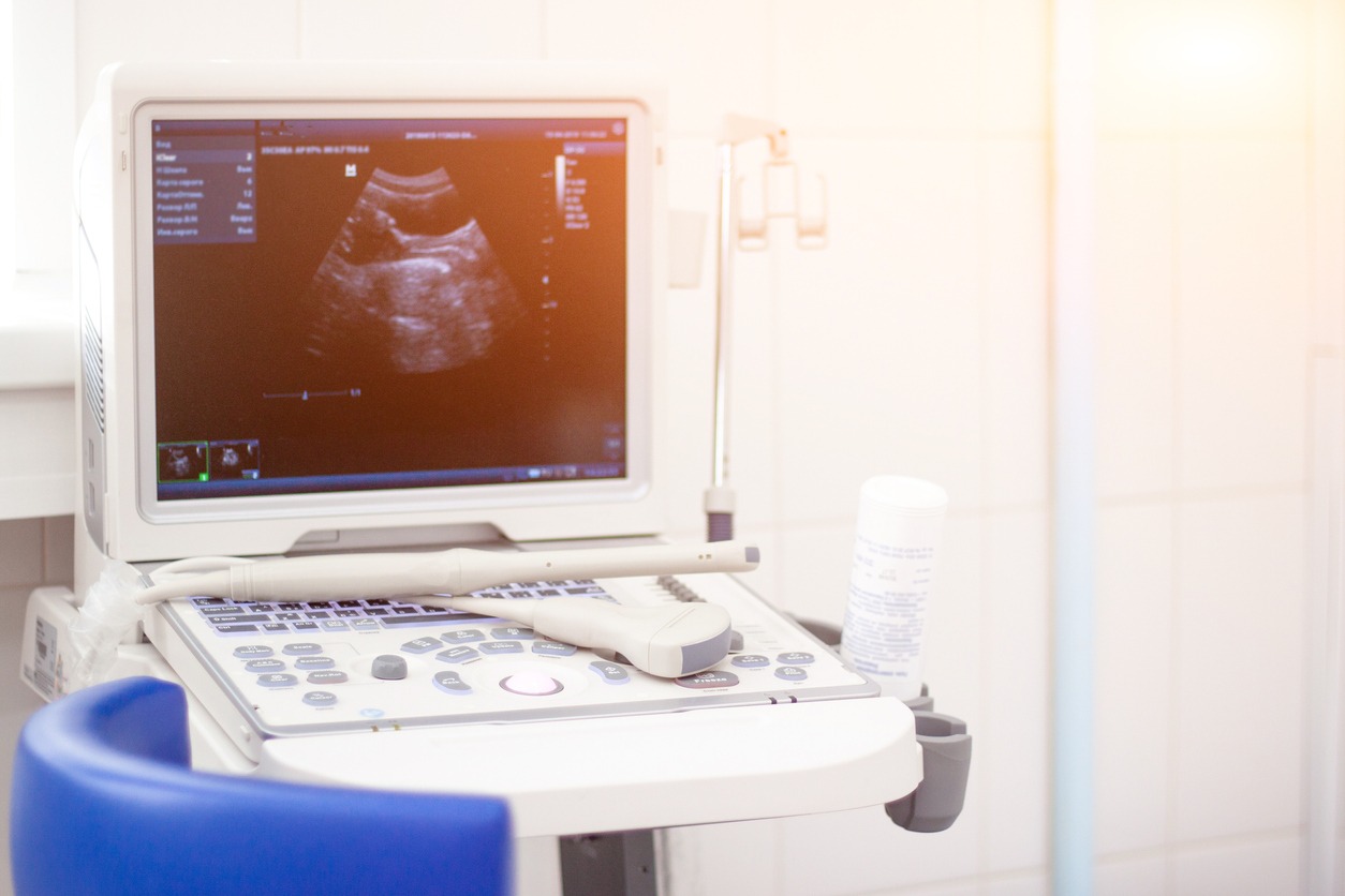 Ecografia transvaginale Roma per PMA: a chi rivolgersi per una diagnostica sicura