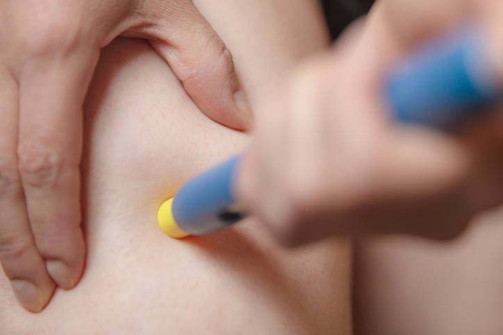 Stimolazione ovarica e rapporti mirati, 6 cose da tenere a mente