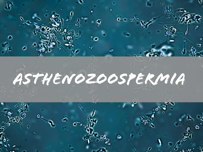 Astenospermia significato e rimedi con la PMA