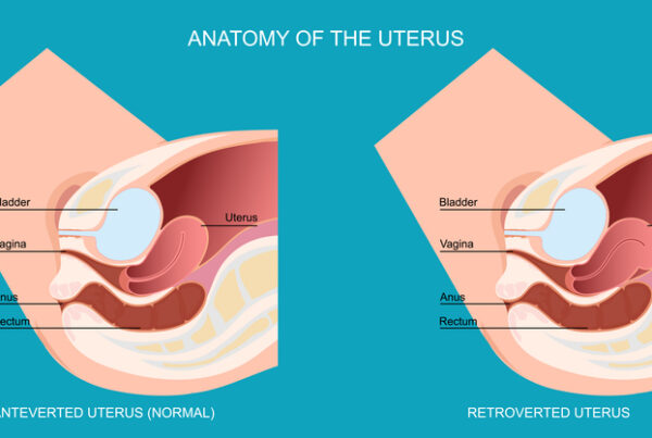 Utero retroflesso: cos’è, cosa comporta, quali rischi per la gravidanza